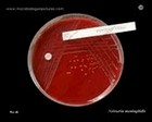 Culture of Neisseria meningitidis on agar plate